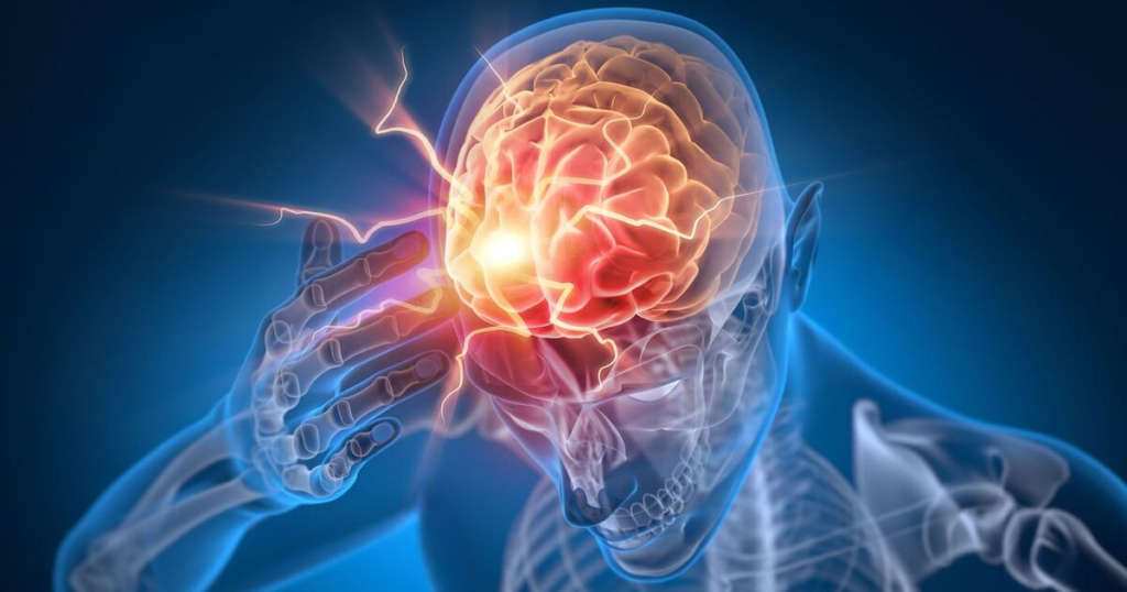 can you sue for brain injury